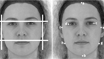 Szélesebb arc, erősebb libidó? Ellentmondásos eredményeket hoztak a kutatások