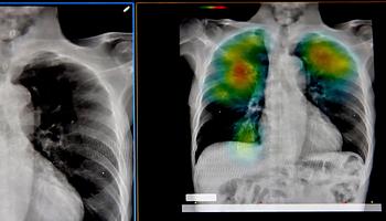 AI-alapú korAI diagnózis: beteg leszel, mielőtt betegnek érzed magad?