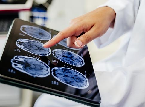 Az agyunk máshogy kezeli a „szabad akaratot”, mint gondolnánk