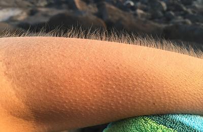 Miért ráz ki a hideg egy jó zenétől? A libabőr tudománya