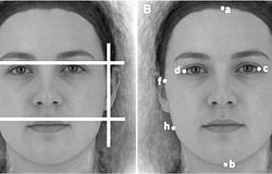 Szélesebb arc, erősebb libidó? Ellentmondásos eredményeket hoztak a kutatások