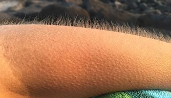 Miért ráz ki a hideg egy jó zenétől? A libabőr tudománya