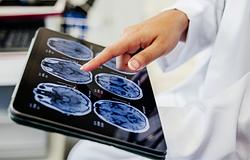 Az agyunk máshogy kezeli a „szabad akaratot”, mint gondolnánk