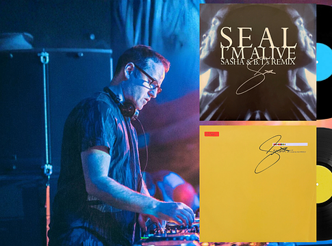 Sasha bakelitárverése 20 országot ért el – két ritkaság Magyarországra is megérkezett