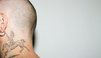 Tetoválás és melanoma: van összefüggés?