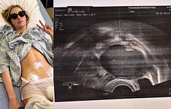 Stella Bossi a megelőzésről beszél: személyes üzenet a kórházból