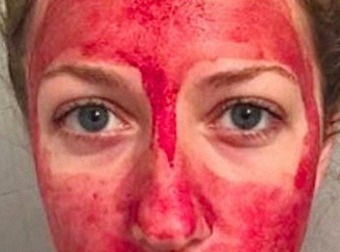 Furcsa szépségtrend hódít: influencerek menstruációs vért kennek az arcukra
